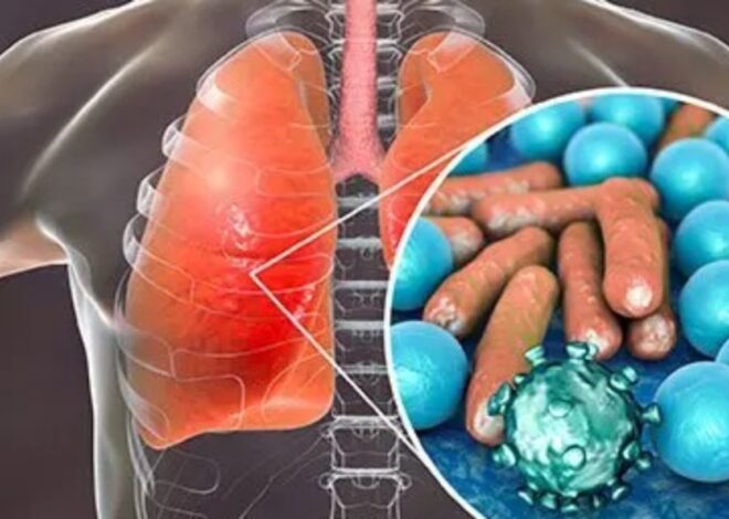 Tibi vs COVID-19: Persamaan & Perbezaan Yang Perlu Anda Tahu