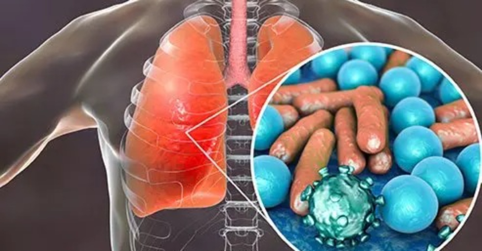 Tibi vs COVID-19: Persamaan & Perbezaan Yang Perlu Anda Tahu